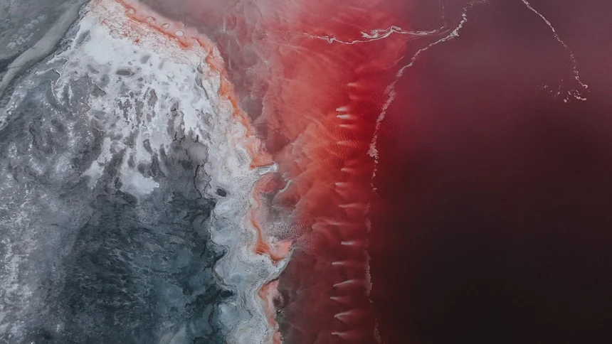 Esophagitis