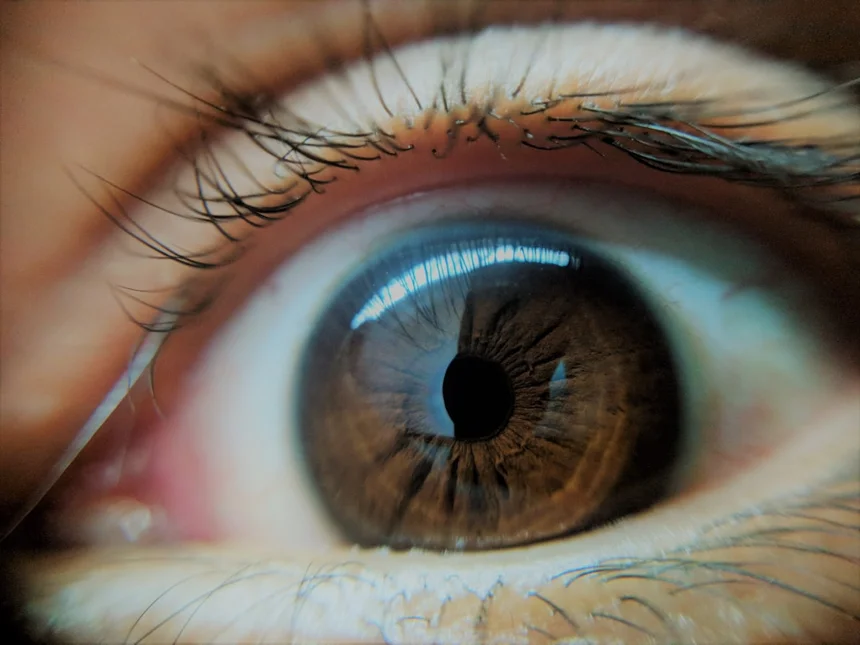 Myopia